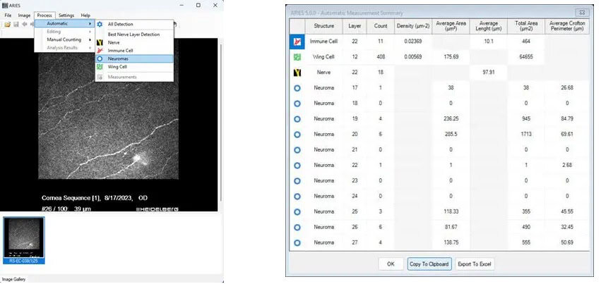 ARIES Interface